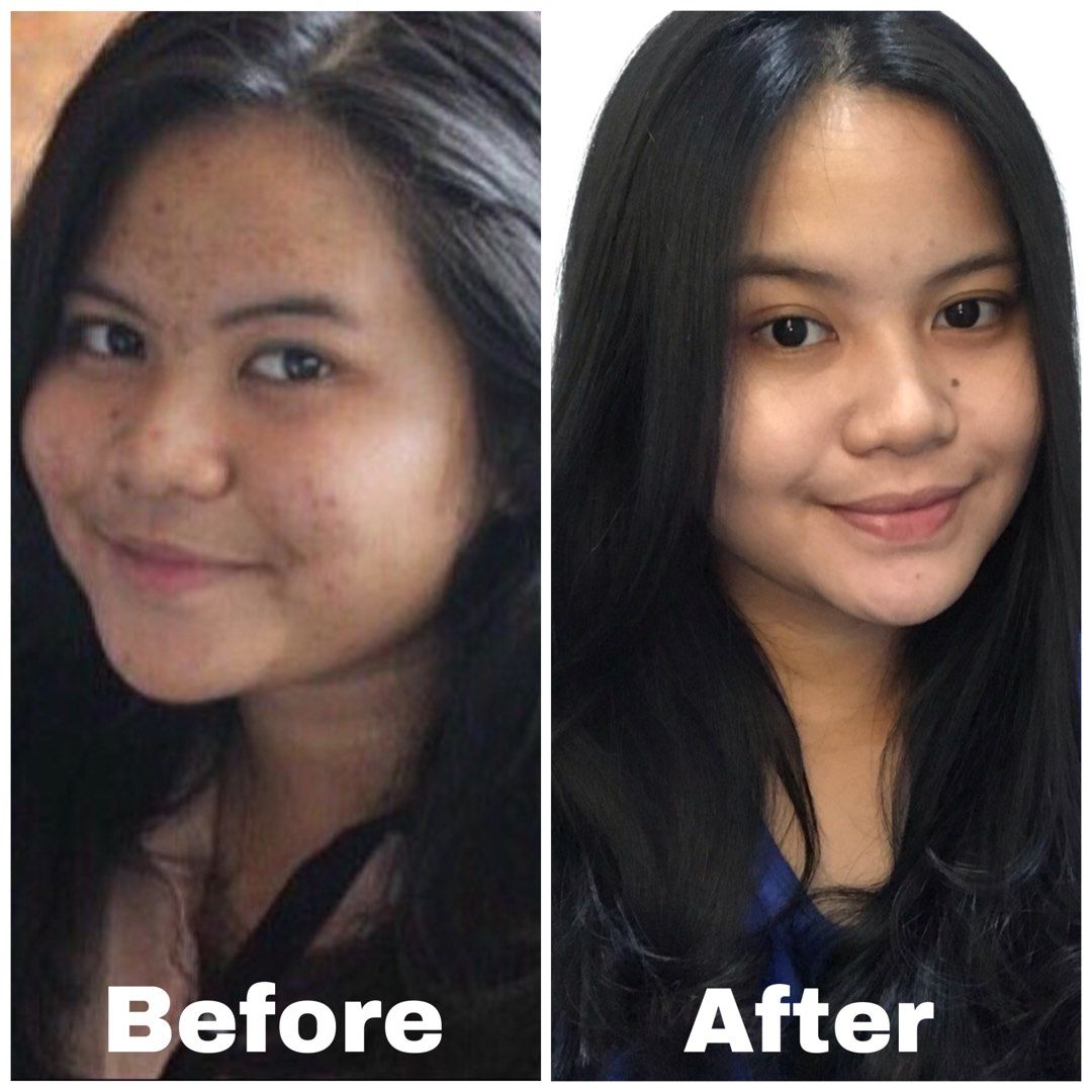 New Binangun and Dayeuhluhur Health Centers: What Can Health & Beauty Businesses Create?